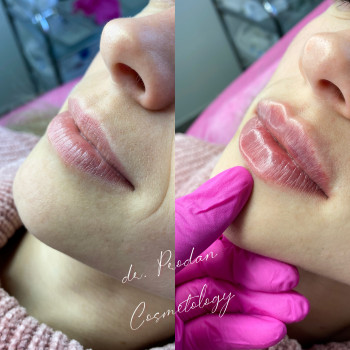 Вікторія Продан, Чернівці Фото - 16