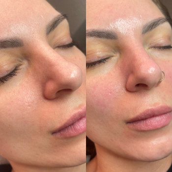 Ирина Борозенец, Киев Фото - 9