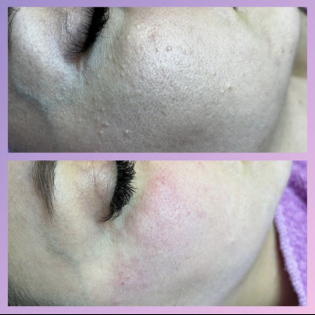 Також підбір домашнього догляду