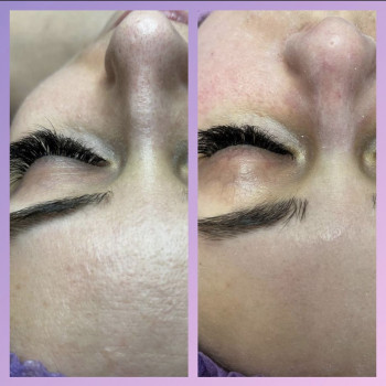 Комбінована чистка обличчя
                    Косметолог-естетист Анастасия Дніпро