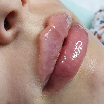 Тетяна Скрильник, Днепр Фото - 5