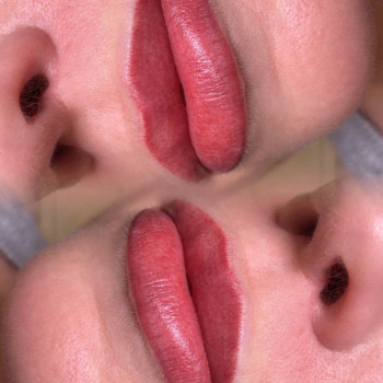 Перманент губ Після процедури