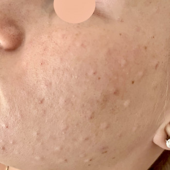 Марина Гречка, Полтава Фото - 11