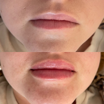 Марина Гречка, Полтава Фото - 13