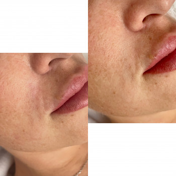 Марина Гречка, Полтава Фото - 14