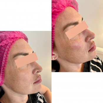 Марина Гречка, Полтава Фото - 16