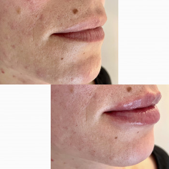 Марина Гречка, Полтава Фото - 18