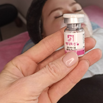 Ботулінотерапія