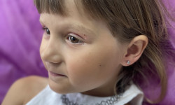 Прокол вух Косметолог-ін'єкціоніст Анна Чернівці