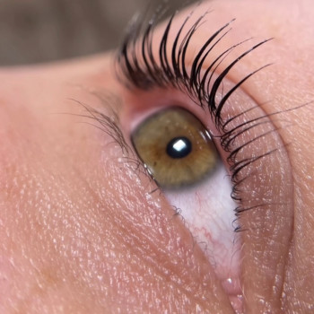 Після процедури