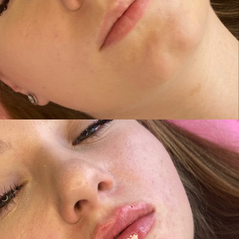 Вікторія Кравченко, Миргород Фото - 23