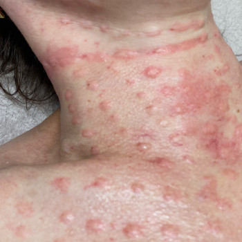 Вікторія Кравченко, Миргород Фото - 24