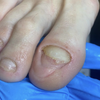 Анна Посунько, Дніпро Фото - 7