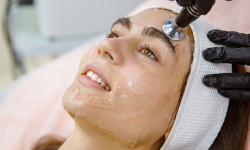 RF-Ліфтинг Косметологический центр Skin Studio Beauty FULL Львов