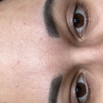 Видалення татуажу губ, брів
                    Косметолог Ірина Вишнёвое