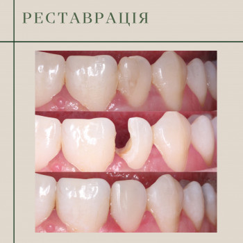 Олександр Ясюк, Житомир Фото - 9