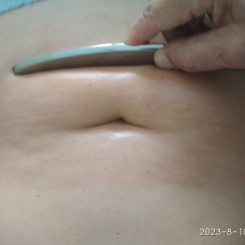 Фото из портфолио специалиста Андрей Бондаренко (реабилитолог, Кривой Рог)