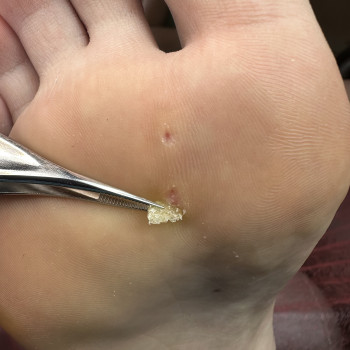 Ирина Дикун, Харьков Фото - 25