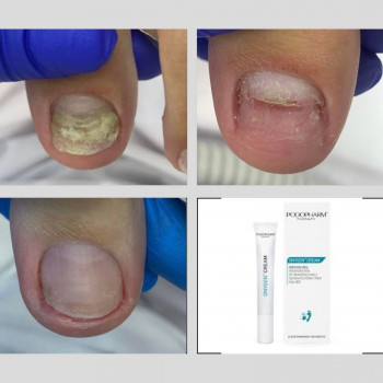 Лаура Токаренко, Київ Фото - 14