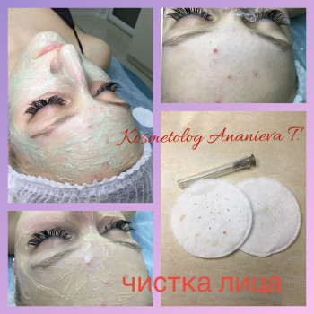 Механическая чистка лица