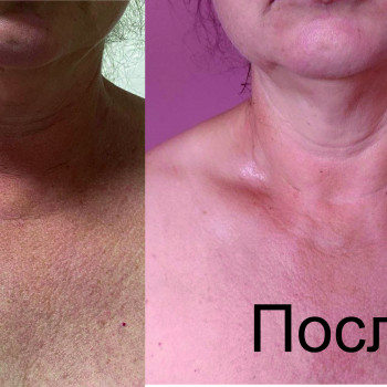 Figura, Кам'янське Фото - 7