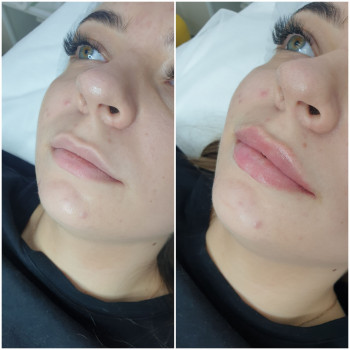 Людмила Ємець, Хмельницький Фото - 28