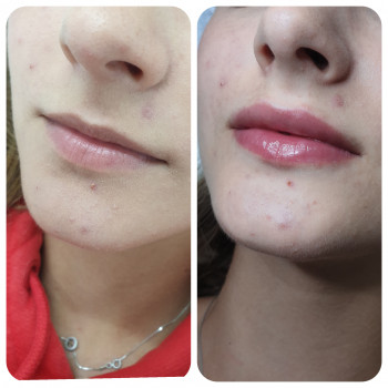 Людмила Ємець, Хмельницький Фото - 32