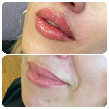 Людмила Ємець, Хмельницький Фото - 33