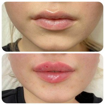 Людмила Ємець, Хмельницький Фото - 34