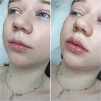 Людмила Ємець, Хмельницький Фото - 25