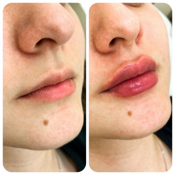 Людмила Ємець, Хмельницький Фото - 35