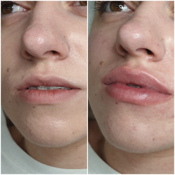 Людмила Ємець, Хмельницький Фото - 38