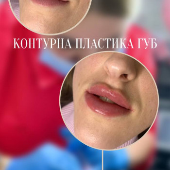 Людмила Ємець, Хмельницький Фото - 43