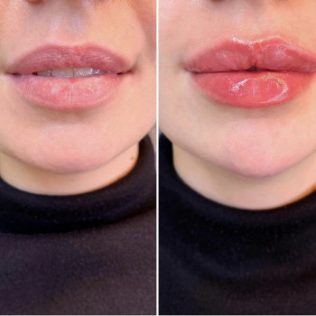 Людмила Ємець, Хмельницький Фото - 36