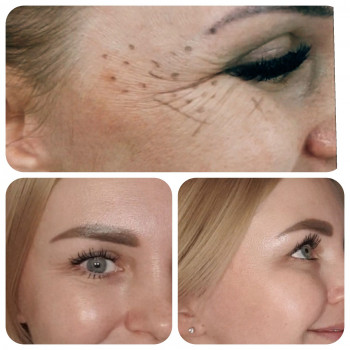 Людмила Ємець, Хмельницький Фото - 6