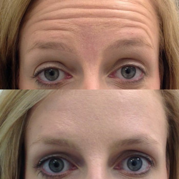 Людмила Ємець, Хмельницький Фото - 10