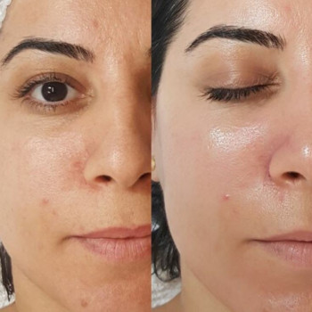 Людмила Ємець, Хмельницький Фото - 16