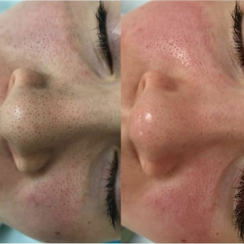 Людмила Ємець, Хмельницький Фото - 20