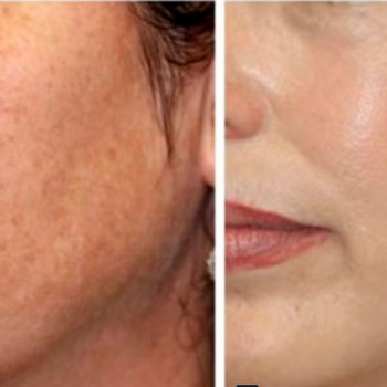 Крістіана Лобода, Київ Фото - 6