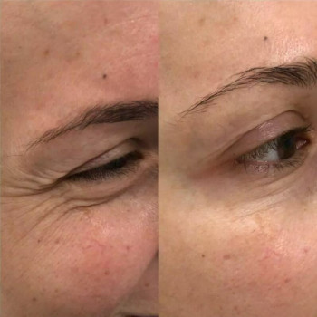 Крістіана Лобода, Київ Фото - 9