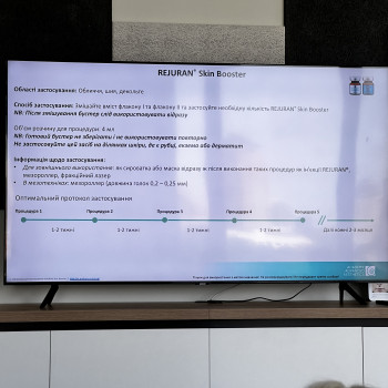 Крістіана Лобода, Київ Фото - 10