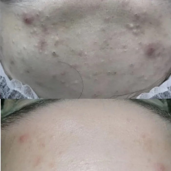 Крістіана Лобода, Київ Фото - 12