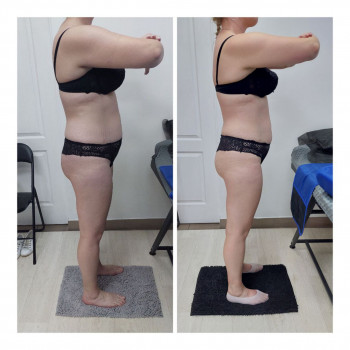 LPG Body Aesthetics, Бровари Фото - 58