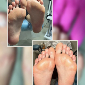 Фото из портфолио специалиста Татьяна Вакула (подолог, Харьков)