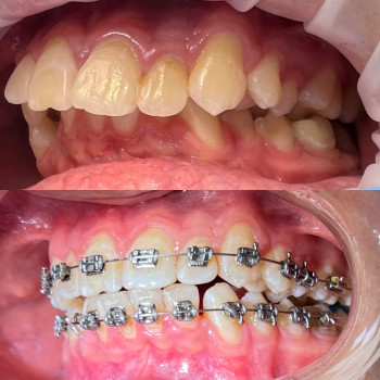 Жанна Мельник Каракай, Винница Фото - 14