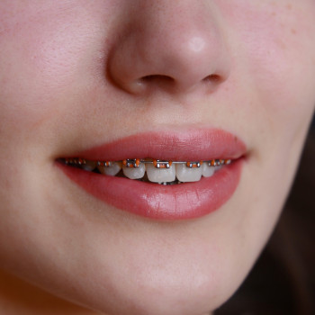 Перманент губ перманентный макияж, фото - Мастер перманентного макияжа Татьяна Леончук