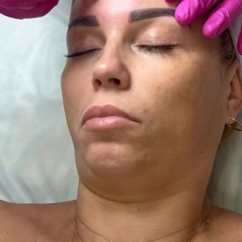 Гідропілінг
                    Косметолог Інга Хмельницкий