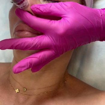 Гідропілінг
                    Косметолог Інга Хмельницкий