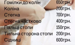 Лазерна епіляція Мастер перманентного макияжа Диана Киев