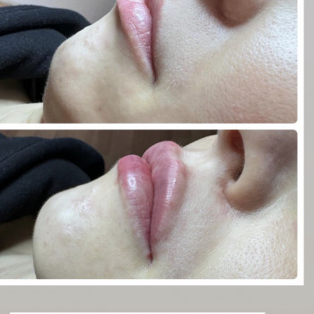 Наталья Татарчук, Одеса Фото - 3